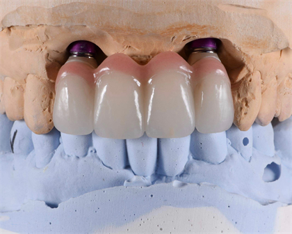 Affordable Dentures Jackson Tn Phone Number - Virtual Phone Numbers Are Really Must To Have In Today�s Modern Time.